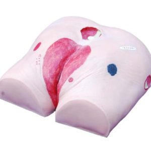 Decubitus Ulcer Care Model