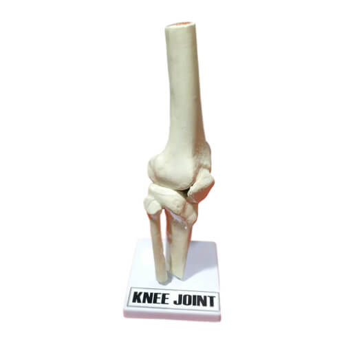Model-of-Knee-Joint-1 Model of Knee Joint - Image 1