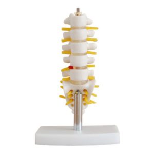 XC-119A Mini Lumbar Vertebrae with Sacrum & Coccyx and Herniated Disc