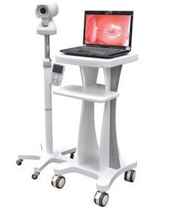 Digital Video Colposcope ELM 2000 Long-Life Cold LED Light